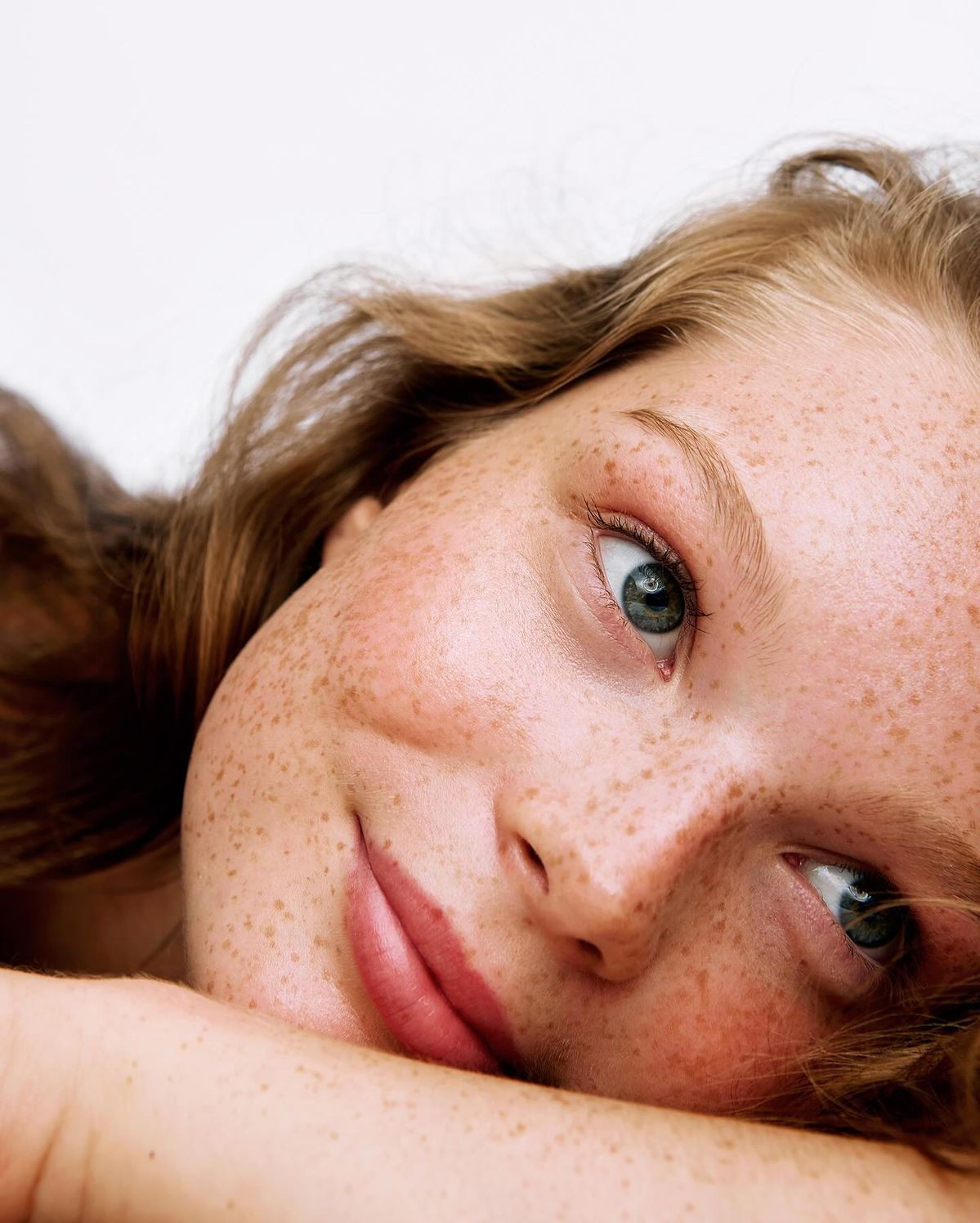 Close-up of woman’s freckled face featured in inclusive beauty PR content by SA Communications PR agency